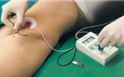 Bloqueio facetário, epidural, radicular, caudal, rizotomia e cordotomia